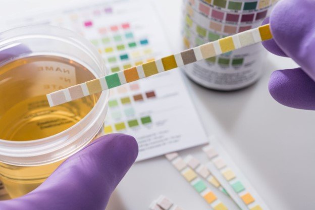 drug & alcohol screening